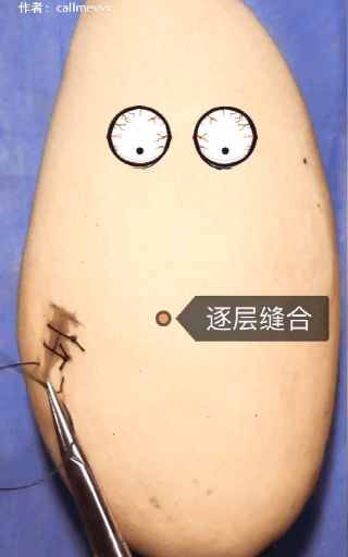 a3c14bc9895e45deb45d29a2f4a58c34.gif